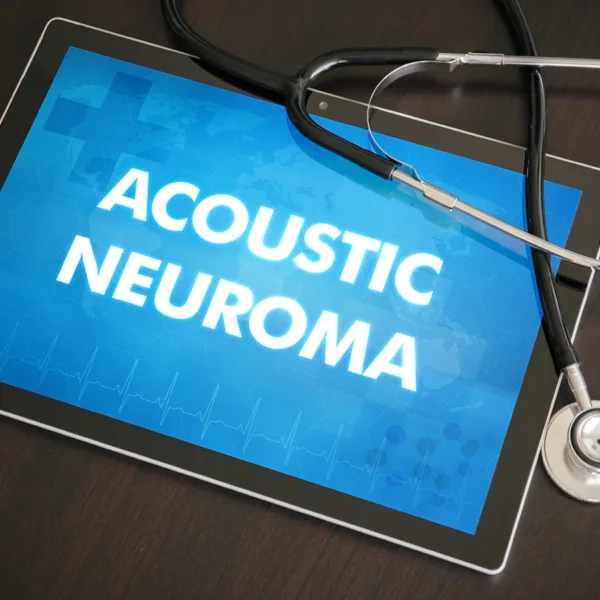Acoustic neuroma (neurological disorder) diagnosis medical concept on tablet screen with stethoscope.