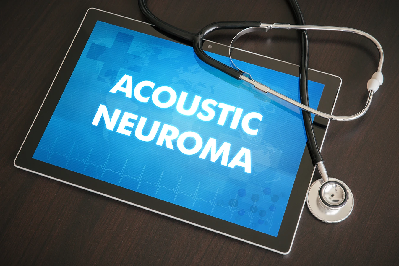 Acoustic neuroma (neurological disorder) diagnosis medical concept on tablet screen with stethoscope.